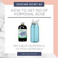 Skincare Secrets: Get Rid of Hormonal Acne by Adding Chlorophyll to your Water